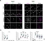 MYOD Antibody in Immunohistochemistry (IHC)