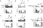 AKT Pan Antibody in Western Blot (WB)