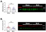 PLP1 Antibody in Western Blot (WB)