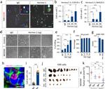 CD335 (NKp46) Antibody in Immunohistochemistry (Paraffin) (IHC (P))