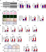 PDGF-D Antibody in Immunohistochemistry (IHC)