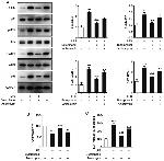 ATF2 Antibody in Western Blot (WB)