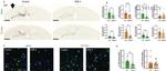 Phospho-Tau (Ser202, Thr205) Antibody in Immunohistochemistry (IHC)