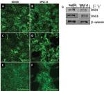 Desmoglein 3 Antibody in Western Blot (WB)