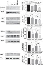 Nrf2 Antibody in Western Blot (WB)