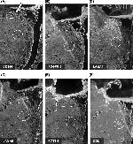 Laminin alpha-5 Antibody in Immunohistochemistry (IHC)