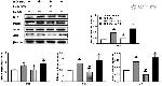 SMO Antibody in Western Blot (WB)