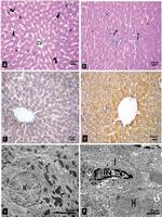 Bcl-2 Antibody in Immunohistochemistry (IHC)