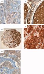 Claudin 3 Antibody in Immunohistochemistry (IHC)