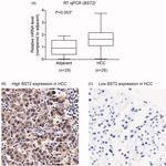 BST-2 Antibody in Immunohistochemistry (IHC)