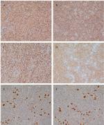 SIRT6 Antibody in Immunohistochemistry (IHC)