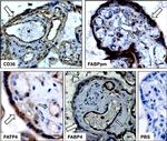 CD36 Antibody in Immunohistochemistry (IHC)