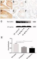 Occludin Antibody in Western Blot, Immunohistochemistry (Paraffin) (WB, IHC (P))