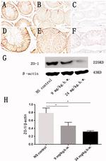 Occludin Antibody in Immunohistochemistry (IHC)