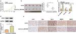 Bcl-2 Antibody in Immunohistochemistry (IHC)