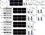 N-cadherin Antibody in Western Blot (WB)