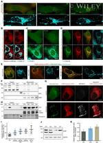 Bax Antibody in Immunocytochemistry (ICC/IF)