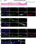 Claudin 4 Antibody in Immunohistochemistry (IHC)