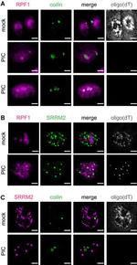 SRRM2 Antibody in Immunocytochemistry (ICC/IF)