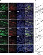 Carbonic Anhydrase IX Antibody in Immunohistochemistry (Frozen) (IHC (F))