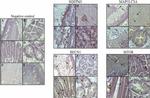 mTOR Antibody in Immunohistochemistry (IHC)