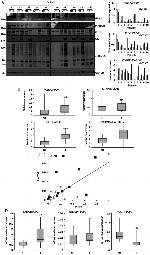 O-linked N-acetylglucosamine (O-GlcNAc) Antibody in Western Blot (WB)