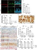 Lysozyme Antibody in Immunohistochemistry (IHC)