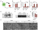 ADAM8 Antibody in Western Blot (WB)