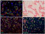 CD271 (NGF Receptor) Antibody in Immunohistochemistry (IHC)