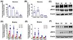 ZBP1 Antibody in Western Blot (WB)