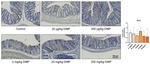 MUC1 Antibody in Immunohistochemistry (IHC)