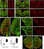 ChAT Antibody in Immunohistochemistry (IHC)