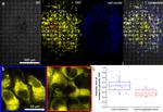 YAP1 Antibody in Immunocytochemistry (ICC/IF)