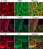 MBP Antibody in Immunohistochemistry (IHC)