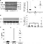 PI3K p85 alpha Antibody in Western Blot (WB)