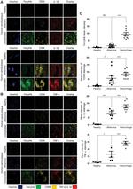 IL-1 beta Antibody in Immunohistochemistry (Paraffin) (IHC (P))