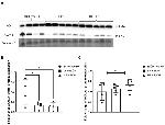 ALDH2 Antibody in Western Blot (WB)