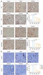 VEGFA Antibody in Immunohistochemistry (IHC)