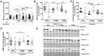 Angiopoietin 2 Antibody in Western Blot (WB)