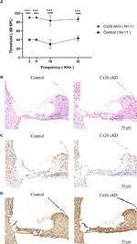 Connexin 30 Antibody in Immunohistochemistry (IHC)