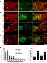 NEFM Antibody in Immunohistochemistry (IHC)