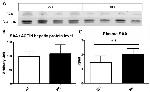 SAA1/SAA2 Antibody in Western Blot (WB)