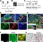 beta Galactosidase Antibody in Immunohistochemistry (IHC)