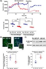 Phospho-VE-cadherin (Tyr658) Antibody in Western Blot (WB)