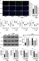 Arginase 1 Antibody in Western Blot (WB)