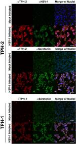 TPH1 Antibody in Immunocytochemistry (ICC/IF)