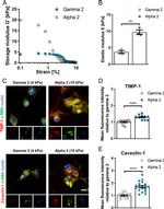 TIMP1 Antibody in Immunocytochemistry (ICC/IF)