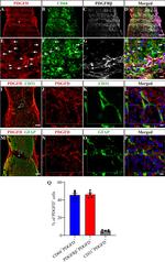 PDGF-D Antibody in Immunohistochemistry (IHC)