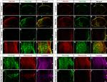 PDGF-D Antibody in Immunohistochemistry (IHC)