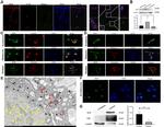 RGR Antibody in Western Blot (WB)